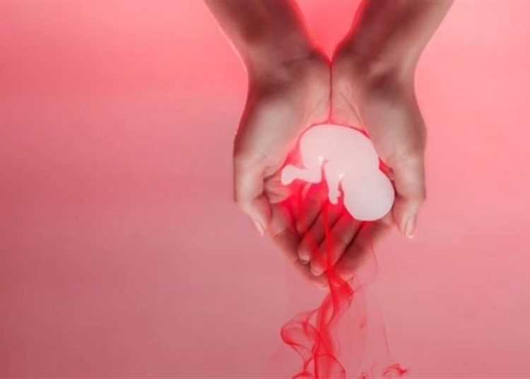 ۳ علت “سقط جنین” در کشور/ سقط تحتتأثیر شعارهای تنظیم خانواده